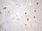c-Kit antibody, LS-C798591, Lifespan Biosciences, Immunohistochemistry paraffin image 