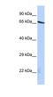 Olfactomedin Like 2A antibody, NBP1-56749, Novus Biologicals, Western Blot image 