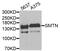 Smoothelin antibody, abx006625, Abbexa, Western Blot image 