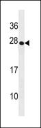 T Cell Receptor Delta Constant antibody, PA5-49144, Invitrogen Antibodies, Western Blot image 