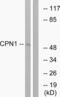 Carboxypeptidase N Subunit 1 antibody, abx014321, Abbexa, Western Blot image 