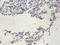Telomerase Reverse Transcriptase antibody, LS-C285702, Lifespan Biosciences, Immunohistochemistry paraffin image 
