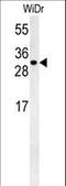 TM2 Domain Containing 3 antibody, LS-C161937, Lifespan Biosciences, Western Blot image 