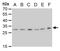 ETHE1 Persulfide Dioxygenase antibody, GTX630994, GeneTex, Western Blot image 