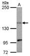Kinesin Family Member 1C antibody, LS-C155192, Lifespan Biosciences, Western Blot image 