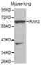 Interleukin 1 Receptor Associated Kinase 2 antibody, abx002082, Abbexa, Western Blot image 