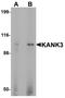 KN Motif And Ankyrin Repeat Domains 3 antibody, A15307, Boster Biological Technology, Western Blot image 