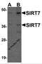 Sirtuin 7 antibody, 5775, ProSci, Western Blot image 