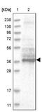 Tetratricopeptide Repeat Domain 1 antibody, PA5-57715, Invitrogen Antibodies, Western Blot image 