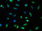 TNFRSF1A Associated Via Death Domain antibody, orb51626, Biorbyt, Immunocytochemistry image 
