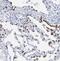 Surfactant Protein C antibody, NBP1-87201, Novus Biologicals, Immunohistochemistry paraffin image 