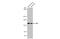 Stromal Antigen 1 antibody, GTX130364, GeneTex, Western Blot image 