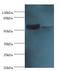 Collapsin Response Mediator Protein 1 antibody, A56927-100, Epigentek, Western Blot image 