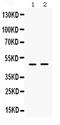 Inhibitor Of Growth Family Member 1 antibody, PB9644, Boster Biological Technology, Western Blot image 