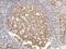SWI/SNF Related, Matrix Associated, Actin Dependent Regulator Of Chromatin, Subfamily A, Member 4 antibody, ab108318, Abcam, Immunohistochemistry paraffin image 