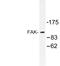 Protein Tyrosine Kinase 2 antibody, LS-C176670, Lifespan Biosciences, Western Blot image 