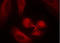 Spleen Associated Tyrosine Kinase antibody, LS-C203093, Lifespan Biosciences, Immunofluorescence image 