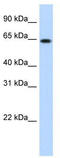 E3 ubiquitin-protein ligase RNF6 antibody, TA329953, Origene, Western Blot image 