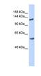 Roundabout Guidance Receptor 2 antibody, NBP1-59546, Novus Biologicals, Western Blot image 
