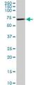 Ribosomal Protein S6 Kinase B1 antibody, H00006198-M04, Novus Biologicals, Western Blot image 