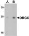 Dorsal Root Ganglia Homeobox antibody, PA5-72713, Invitrogen Antibodies, Western Blot image 