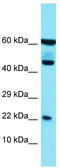 Phospholipase A2 Group XIIB antibody, TA333609, Origene, Western Blot image 