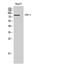 cGMP-gated cation channel alpha-1 antibody, A05494-1, Boster Biological Technology, Western Blot image 