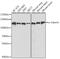 Catenin Alpha 1 antibody, GTX32433, GeneTex, Western Blot image 