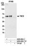 Tubulin Folding Cofactor E antibody, A305-450A, Bethyl Labs, Immunoprecipitation image 