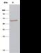 Carboxypeptidase Vitellogenic Like antibody, GTX02282, GeneTex, Immunoprecipitation image 