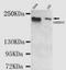 Lysine Demethylase 5C antibody, orb178828, Biorbyt, Western Blot image 