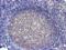 Schlafen Like 1 antibody, M16928-1, Boster Biological Technology, Immunohistochemistry paraffin image 