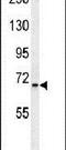 Solute Carrier Family 25 Member 12 antibody, PA5-23778, Invitrogen Antibodies, Western Blot image 