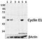 Cyclin E1 antibody, GTX66617, GeneTex, Western Blot image 