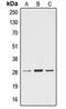 Ephrin A4 antibody, LS-C352141, Lifespan Biosciences, Western Blot image 