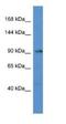 TNNI3 Interacting Kinase antibody, NBP1-79279, Novus Biologicals, Western Blot image 