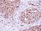 RAD23 Homolog B, Nucleotide Excision Repair Protein antibody, NBP2-16825, Novus Biologicals, Immunohistochemistry paraffin image 
