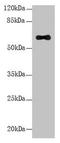 Leucine Rich Repeat Containing 31 antibody, LS-C399154, Lifespan Biosciences, Western Blot image 