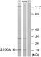 S100 Calcium Binding Protein A16 antibody, GTX87170, GeneTex, Western Blot image 