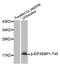 Eukaryotic Translation Initiation Factor 4E Binding Protein 1 antibody, LS-C335879, Lifespan Biosciences, Western Blot image 