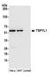 TSPY Like 1 antibody, A304-852A, Bethyl Labs, Western Blot image 