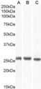 Connexin-26 antibody, NB100-57840, Novus Biologicals, Western Blot image 