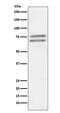 ADAM Metallopeptidase Domain 10 antibody, M00566, Boster Biological Technology, Western Blot image 