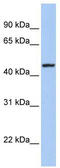 Retinal Outer Segment Membrane Protein 1 antibody, TA335221, Origene, Western Blot image 