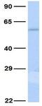 5-Hydroxytryptamine Receptor 2C antibody, GTX77700, GeneTex, Western Blot image 