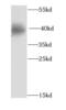 Eukaryotic Translation Initiation Factor 3 Subunit M antibody, FNab02714, FineTest, Western Blot image 