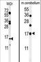 Tubulin polymerization-promoting protein family member 3 antibody, LS-C160144, Lifespan Biosciences, Western Blot image 