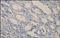 Interleukin 6 Receptor antibody, 252201, Abbiotec, Immunohistochemistry paraffin image 