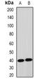 UbiA Prenyltransferase Domain Containing 1 antibody, orb341326, Biorbyt, Western Blot image 