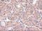 Patched 1 antibody, NBP1-47945, Novus Biologicals, Immunohistochemistry paraffin image 